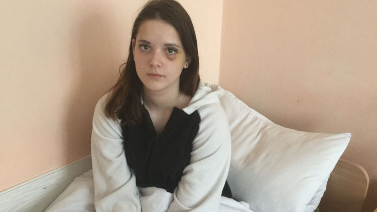 Случай черниговской школьницы Полины Малоштан стал первым резонансным избиением подростков в Украине. Фото: Страна 