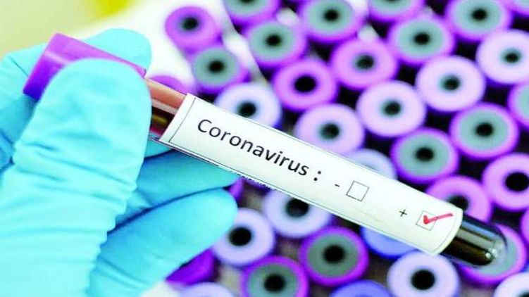 Тестов на коронавирус в Украине не хватает. Фото из открытых источников