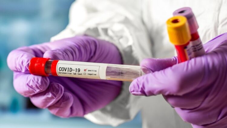 Бесплатный тест на коронавирус стал настоящим квестом. При этом чиновники утверждают, что проблем нет. Фото из открытых источников