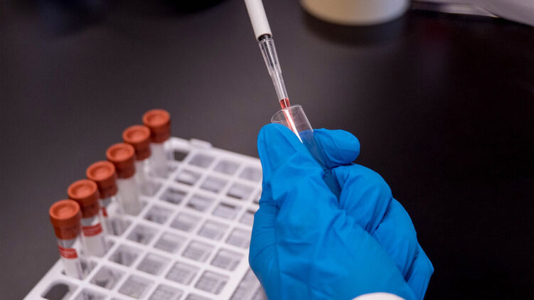 Тестирование на коронавирус. Фото Гарвардского университета
