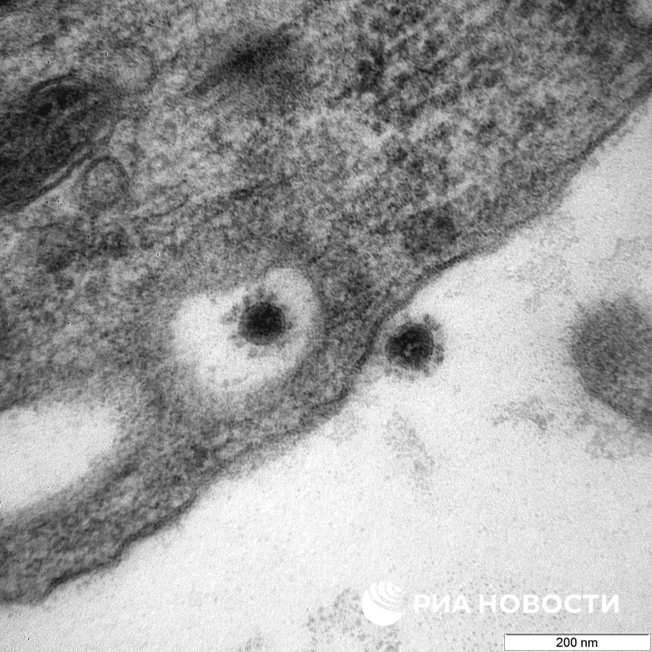 фото штамма коронавируса "Дельта"