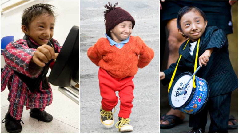 Самый маленький человек в мире Хагенда Тапа Магар