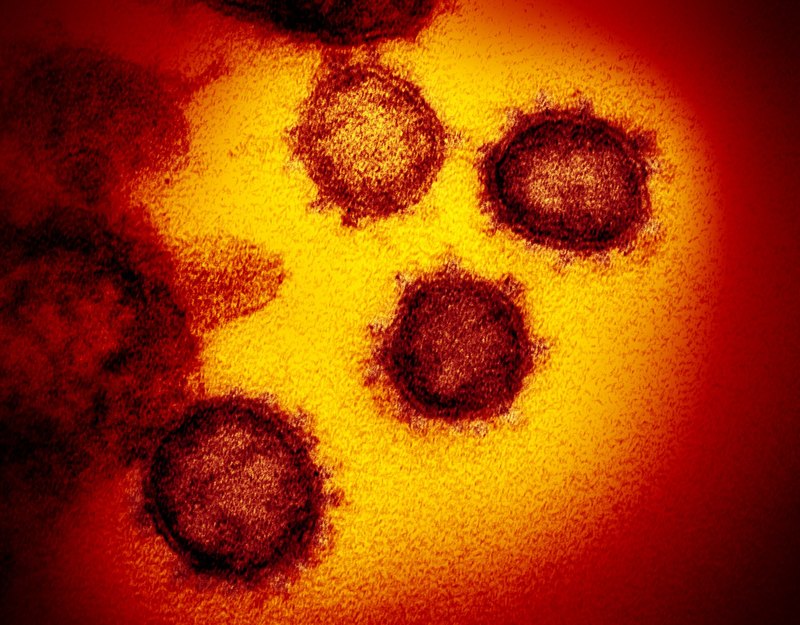 шипы на поверхности вируса COVID-19