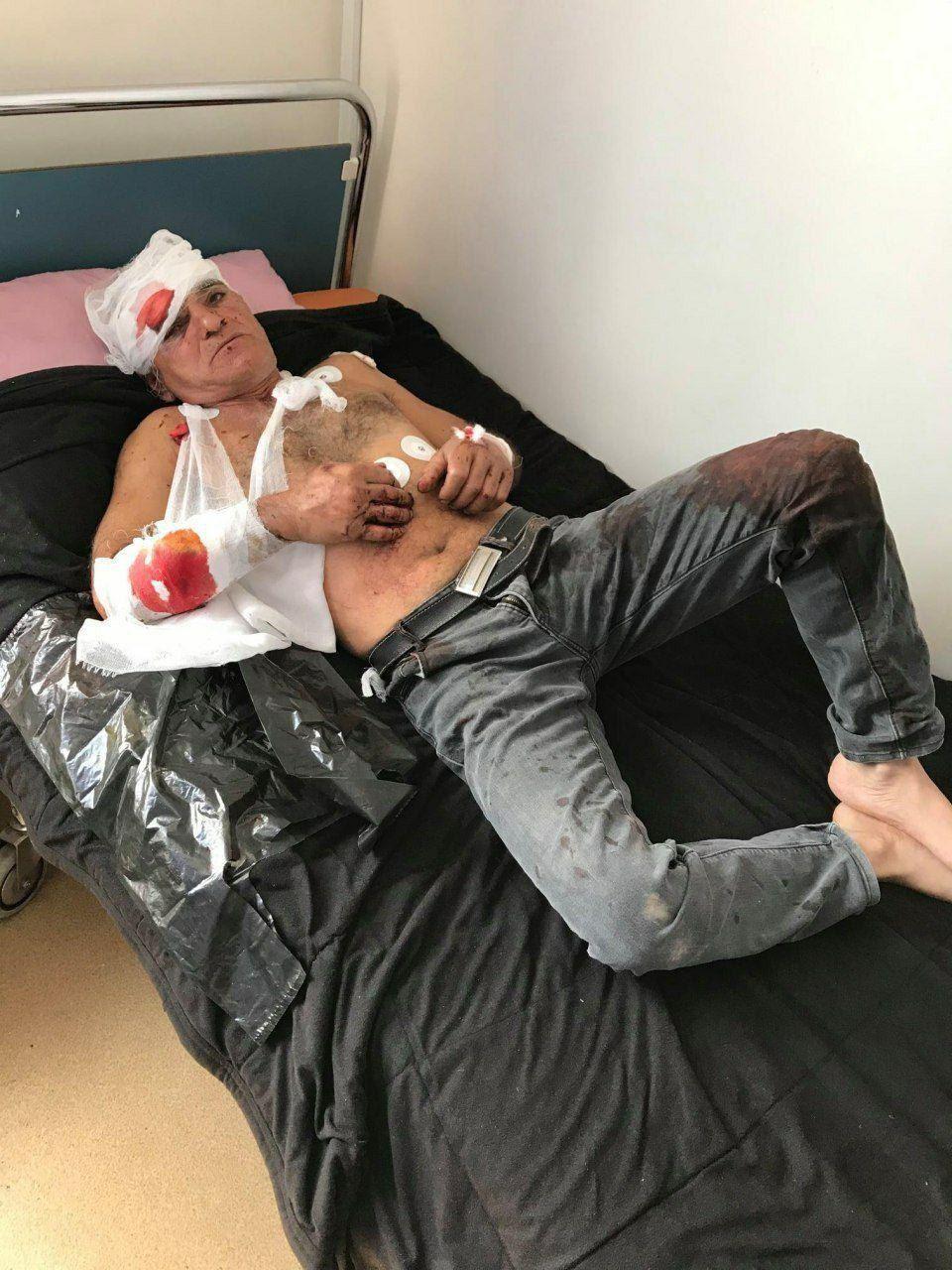 Фото раненых в Карабахе. Телеграм