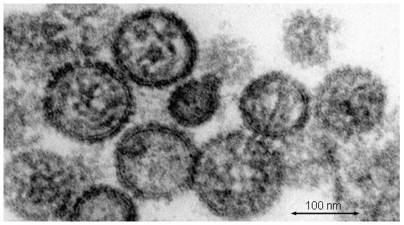 Хантавирус под микроскопом. Фото: Шарите