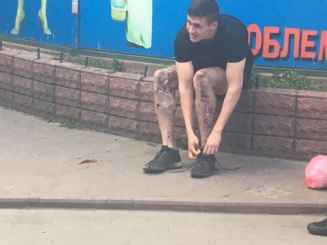 Пострадавший при взрыве у метро "Шулявская". Фото: Канал 24