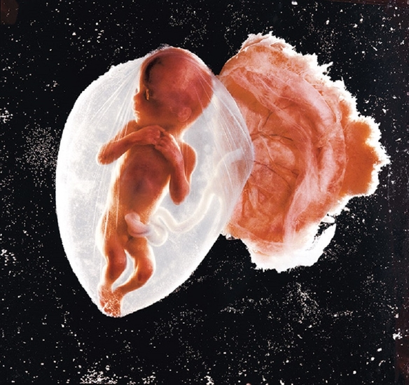 Эмбрион, 1965 год 
Фото: Lennart Nilsson